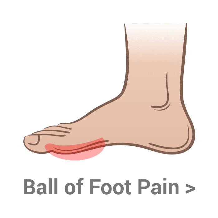 Ball of Foot Kassis Brother's Shoes